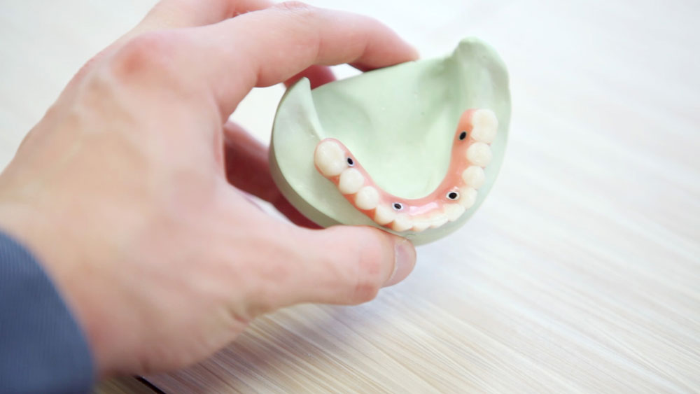 hareketli protezler – Özel İlke Ağız ve Diş Sağlığı Polikliniği