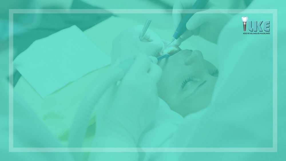 dis beyazlatma blog banner e1597589179733 – Özel İlke Ağız ve Diş Sağlığı Polikliniği