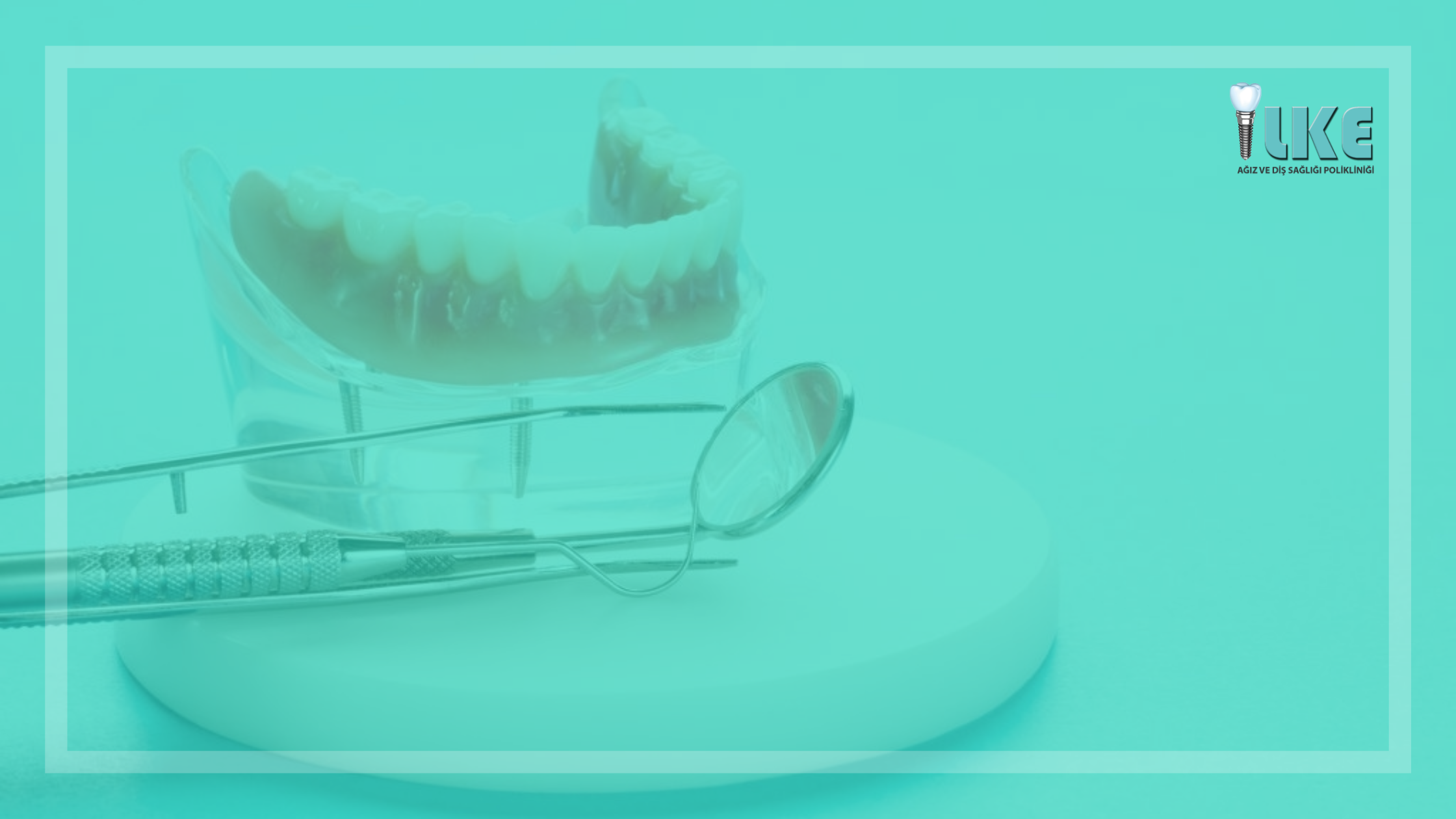 izmir dis protezi blog banner – Özel İlke Ağız ve Diş Sağlığı Polikliniği