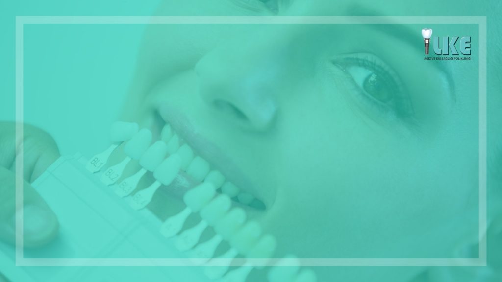 muz kabugu ile dis beyazlatma mumkun mu – Özel İlke Ağız ve Diş Sağlığı Polikliniği